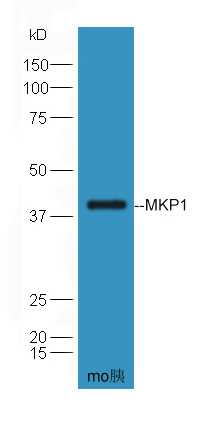 Lane 1: Mouse Pancreas lysates probed with DUSP1/MKP1 Polyclonal Antibody, Unconjugated (bs1851R) at 1:300 dilution and 4˚C overnight incubation. Followed by conjugated secondary antibody incubation at 1:20000 for 60 min at 37˚C.