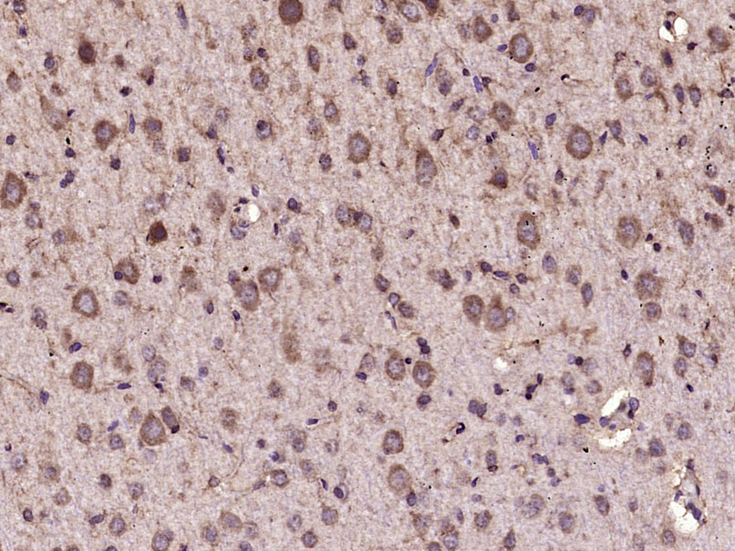 Paraformaldehyde-fixed, paraffin embedded Rat brain; Antigen retrieval by boiling in sodium citrate buffer (pH6.0) for 15min; Block endogenous peroxidase by 3% hydrogen peroxide for 20 minutes; Blocking buffer (normal goat serum) at 37°C for 30min; Antibody incubation with CAMKK2 Polyclonal Antibody, Unconjugated (bs-6253R) at 1:400 overnight at 4°C, DAB staining.