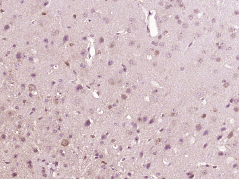 Paraformaldehyde-fixed, paraffin embedded Mouse brain; Antigen retrieval by boiling in sodium citrate buffer (pH6.0) for 15min; Block endogenous peroxidase by 3% hydrogen peroxide for 20 minutes; Blocking buffer (normal goat serum) at 37°C for 30min; Antibody incubation with Eph receptor A3 Polyclonal Antibody, Unconjugated (bs-7032R) at 1:400 overnight at 4°C, DAB staining.
