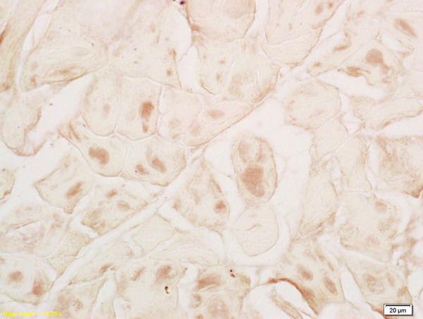 Formalin-fixed and paraffin embedded rat skeletal muscle labeled with Rabbit Anti MYPN Polyclonal Antibody, Unconjugated (bs-10366R) at 1:200 followed by conjugation to the secondary antibody and DAB staining Formalin-fixed and paraffin embedded rat skeletal muscle labeled with Rabbit Anti MYPN Polyclonal Antibody, Unconjugated (bs-10366R) at 1:200 followed by conjugation to the secondary antibody and DAB staining
