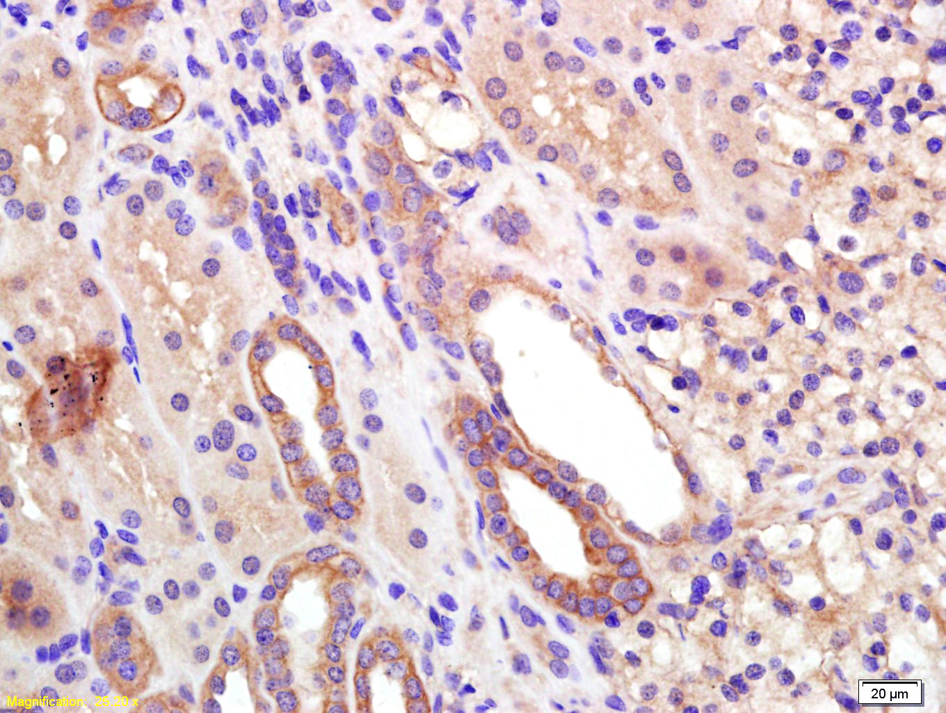 Paraformaldehyde-fixed, paraffin embedded Human kidney; Antigen retrieval by boiling in sodium citrate buffer (pH6.0) for 15min; Block endogenous peroxidase by 3% hydrogen peroxide for 20 minutes; Blocking buffer (normal goat serum) at 37°C for 30min; Antibody incubation with EDG3 Polyclonal Antibody, Unconjugated (bs-7541R) at 1:200 overnight at 4°C, DAB staining.
