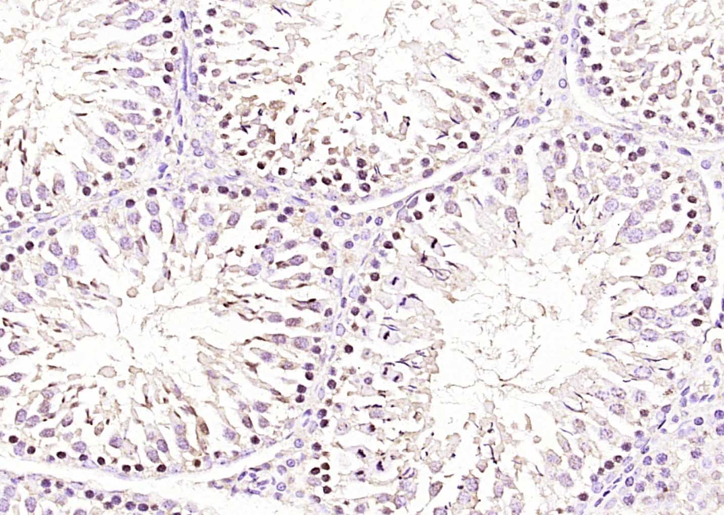 Paraformaldehyde-fixed, paraffin embedded Rat testis; Antigen retrieval by boiling in sodium citrate buffer (pH6.0) for 15min; Block endogenous peroxidase by 3% hydrogen peroxide for 20 minutes; Blocking buffer (normal goat serum) at 37°C for 30min; Antibody incubation with RNF138 Polyclonal Antibody, Unconjugated (bs-9254R) at 1:400 overnight at 4°C, DAB staining.