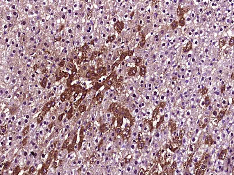 Paraformaldehyde-fixed, paraffin embedded Rat liver; Antigen retrieval by boiling in sodium citrate buffer (pH6.0) for 15min; Block endogenous peroxidase by 3% hydrogen peroxide for 20 minutes; Blocking buffer (normal goat serum) at 37°C for 30min; Antibody incubation with Factor H Polyclonal Antibody, Unconjugated (bs-9525R) at 1:400 overnight at 4°C, DAB staining.