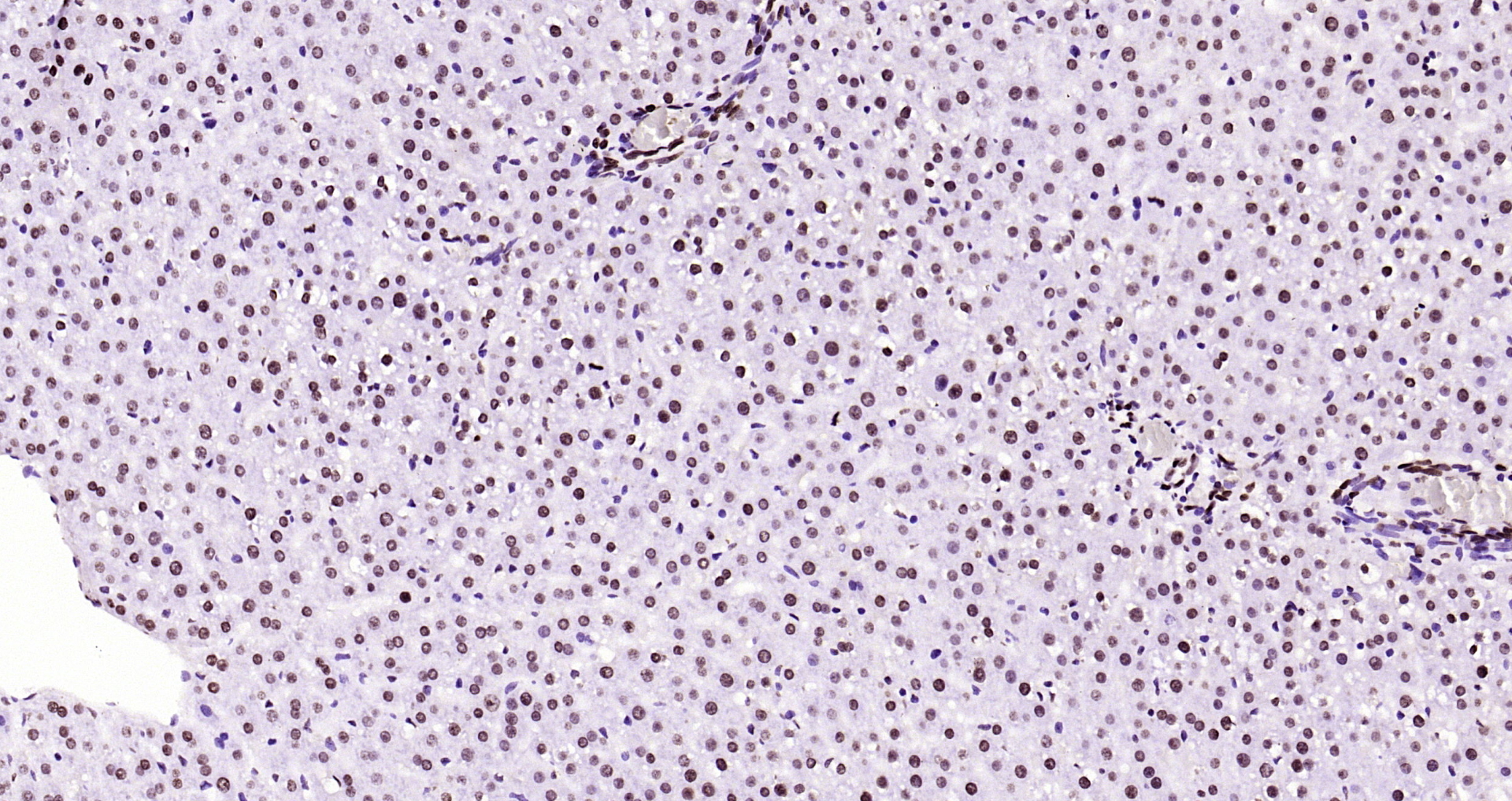 Paraformaldehyde-fixed, paraffin embedded Rat liver; Antigen retrieval by boiling in sodium citrate buffer (pH6.0) for 15min; Block endogenous peroxidase by 3% hydrogen peroxide for 20 minutes; Blocking buffer (normal goat serum) at 37°C for 30min; Antibody incubation with Histone H3(di methyl K79) Monoclonal Antibody, Unconjugated (bsm-33123M) at 1:200 overnight at 4°C, DAB staining.