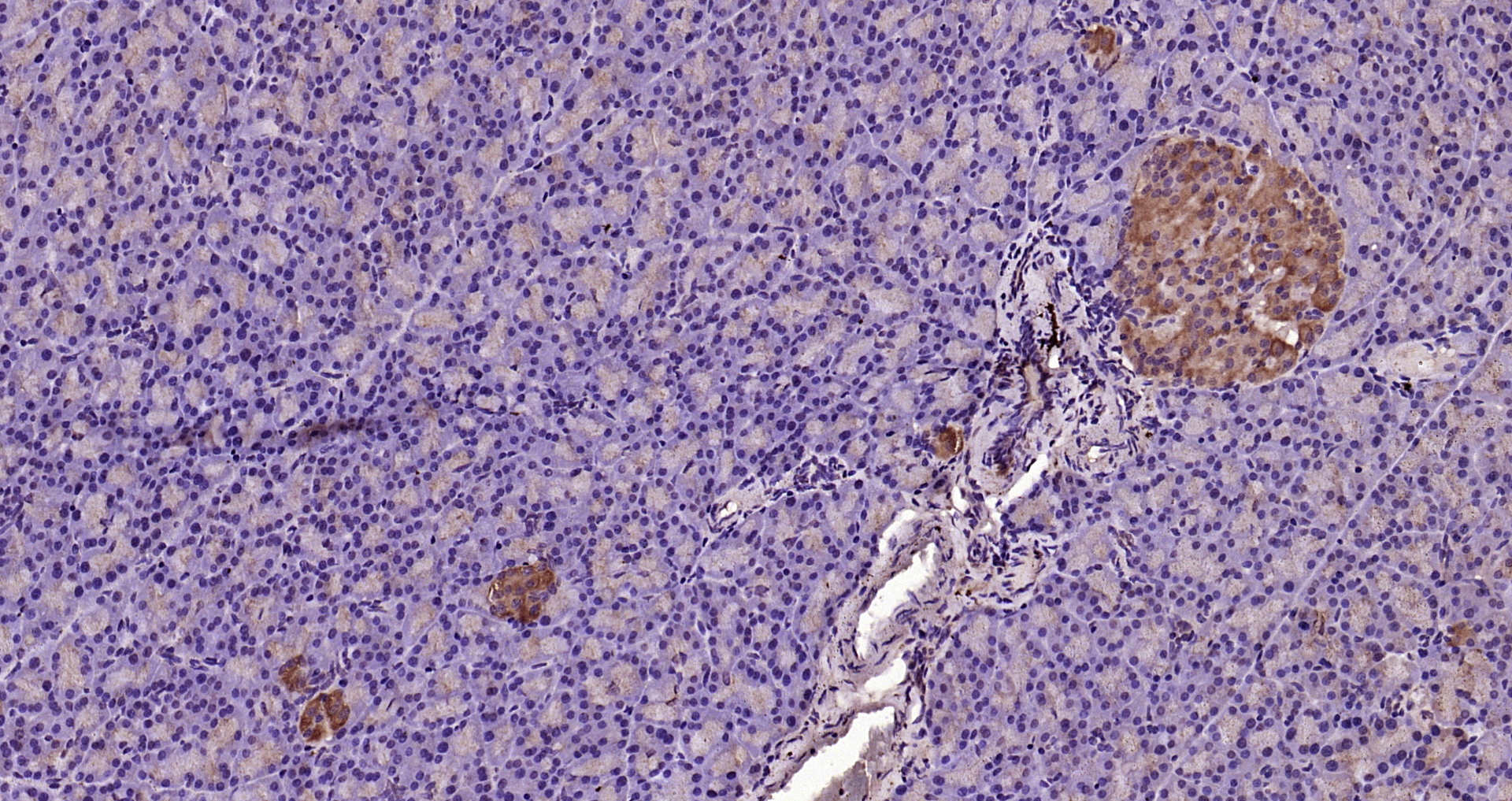 Paraformaldehyde-fixed, paraffin embedded Rat pancreas; Antigen retrieval by boiling in sodium citrate buffer (pH6.0) for 15min; Block endogenous peroxidase by 3% hydrogen peroxide for 20 minutes; Blocking buffer (normal goat serum) at 37°C for 30min; Antibody incubation with Caspase 9 Polyclonal Antibody, Unconjugated (bs-0049R) at 1:200 overnight at 4°C, DAB staining.