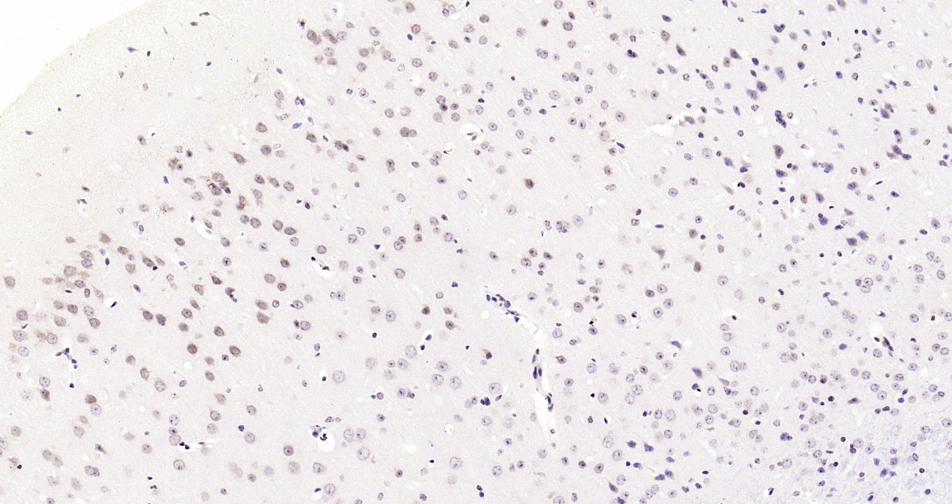 Paraformaldehyde-fixed, paraffin embedded Mouse brain; Antigen retrieval by boiling in sodium citrate buffer (pH6.0) for 15min; Block endogenous peroxidase by 3% hydrogen peroxide for 20 minutes; Blocking buffer (normal goat serum) at 37°C for 30min; Antibody incubation with JNK1+2+3 (T183+Y185) Polyclonal Antibody, Unconjugated (bs-1640R) at 1:200 overnight at 4°C, DAB staining.