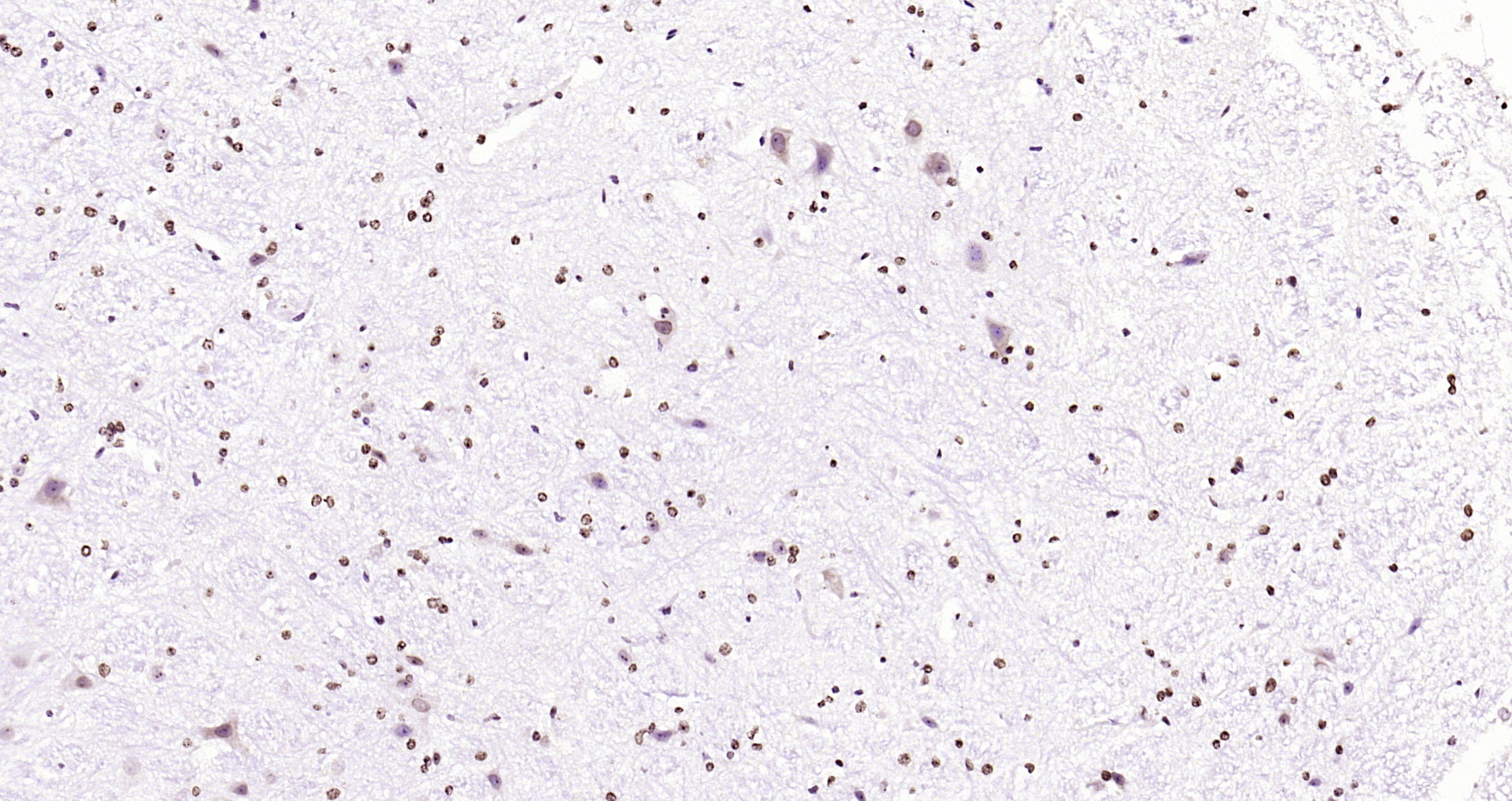 Paraformaldehyde-fixed, paraffin embedded Mouse cerebellum; Antigen retrieval by boiling in sodium citrate buffer (pH6.0) for 15min; Block endogenous peroxidase by 3% hydrogen peroxide for 20 minutes; Blocking buffer (normal goat serum) at 37°C for 30min; Antibody incubation with JNK1+2+3 (T183+Y185) Polyclonal Antibody, Unconjugated (bs-1640R) at 1:200 overnight at 4°C, DAB staining.