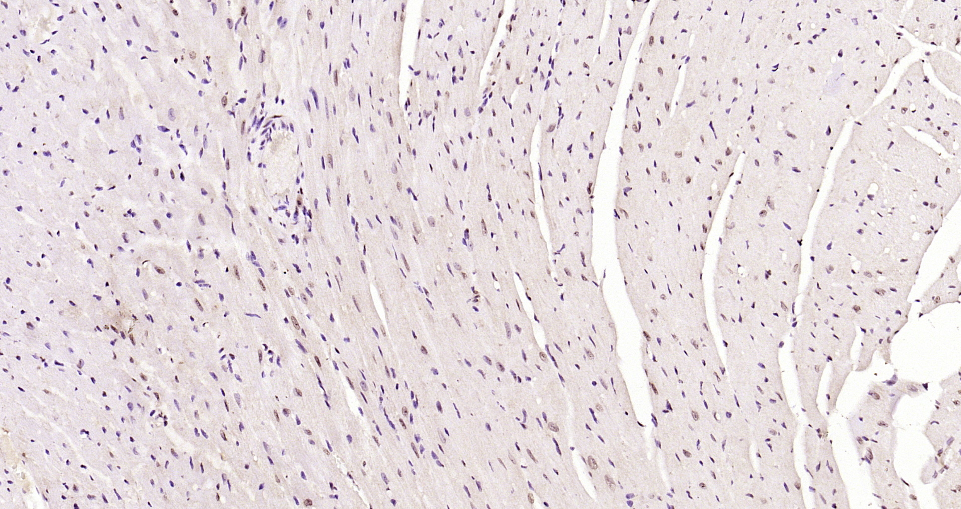 Paraformaldehyde-fixed, paraffin embedded Mouse heart; Antigen retrieval by boiling in sodium citrate buffer (pH6.0) for 15min; Block endogenous peroxidase by 3% hydrogen peroxide for 20 minutes; Blocking buffer (normal goat serum) at 37°C for 30min; Antibody incubation with JNK1+2+3 (T183+Y185) Polyclonal Antibody, Unconjugated (bs-1640R) at 1:200 overnight at 4°C, DAB staining.