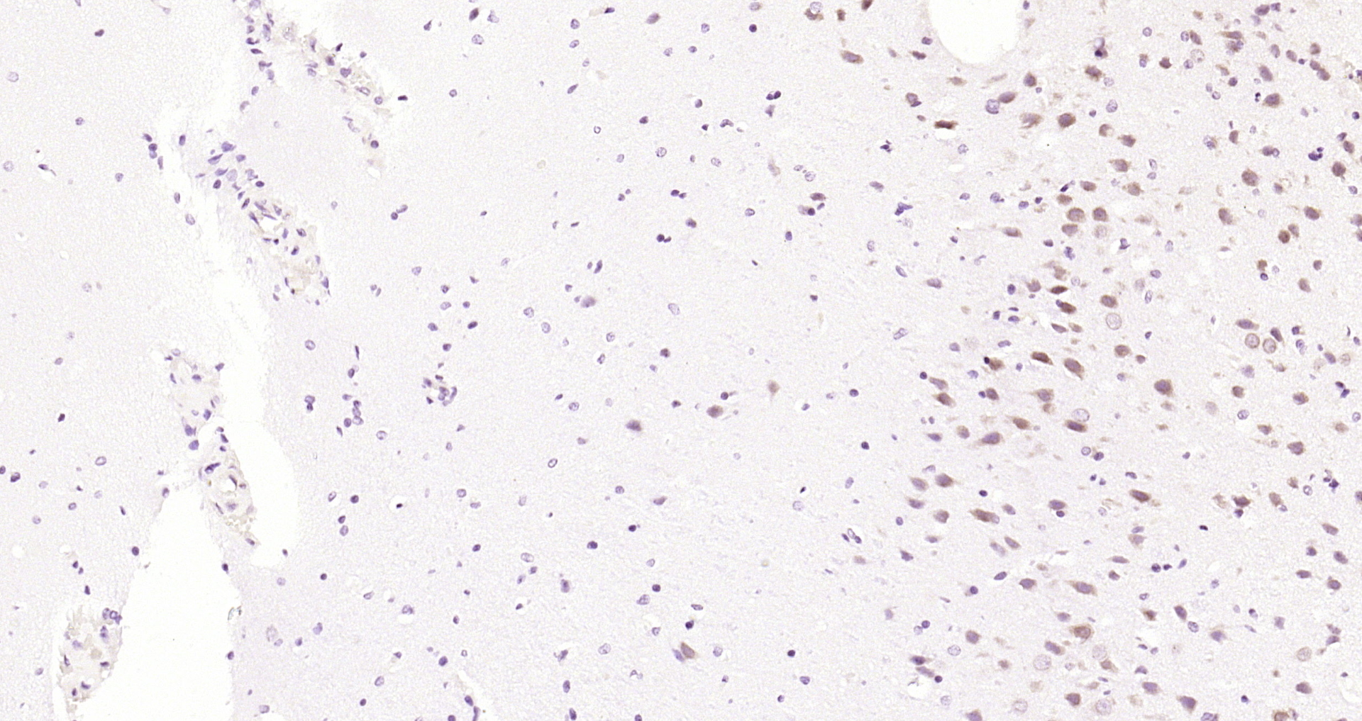 Paraformaldehyde-fixed, paraffin embedded Rat brain; Antigen retrieval by boiling in sodium citrate buffer (pH6.0) for 15min; Block endogenous peroxidase by 3% hydrogen peroxide for 20 minutes; Blocking buffer (normal goat serum) at 37°C for 30min; Antibody incubation with JNK1+2+3 (T183+Y185) Polyclonal Antibody, Unconjugated (bs-1640R) at 1:200 overnight at 4°C, DAB staining.