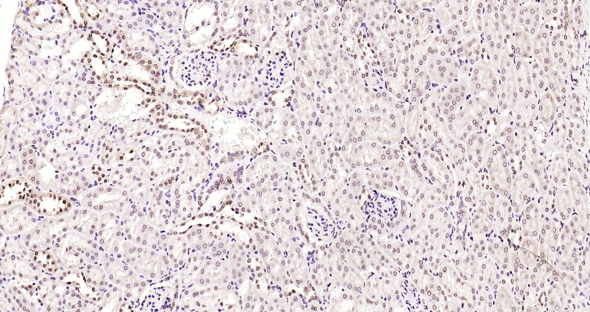 Paraformaldehyde-fixed, paraffin embedded Rat kidney; Antigen retrieval by boiling in sodium citrate buffer (pH6.0) for 15min; Block endogenous peroxidase by 3% hydrogen peroxide for 20 minutes; Blocking buffer (normal goat serum) at 37°C for 30min; Antibody incubation with JNK1+2+3 (T183+Y185) Polyclonal Antibody, Unconjugated (bs-1640R) at 1:200 overnight at 4°C, DAB staining.