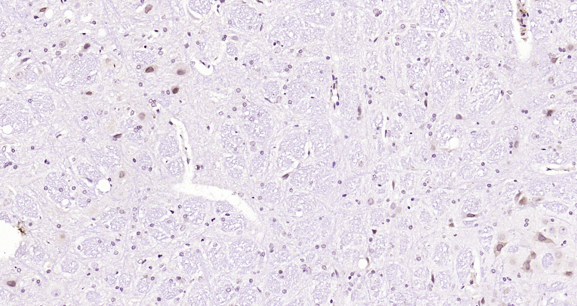 Paraformaldehyde-fixed, paraffin embedded Rat cerebellum; Antigen retrieval by boiling in sodium citrate buffer (pH6.0) for 15min; Block endogenous peroxidase by 3% hydrogen peroxide for 20 minutes; Blocking buffer (normal goat serum) at 37°C for 30min; Antibody incubation with JNK1+2+3 (T183+Y185) Polyclonal Antibody, Unconjugated (bs-1640R) at 1:200 overnight at 4°C, DAB staining.