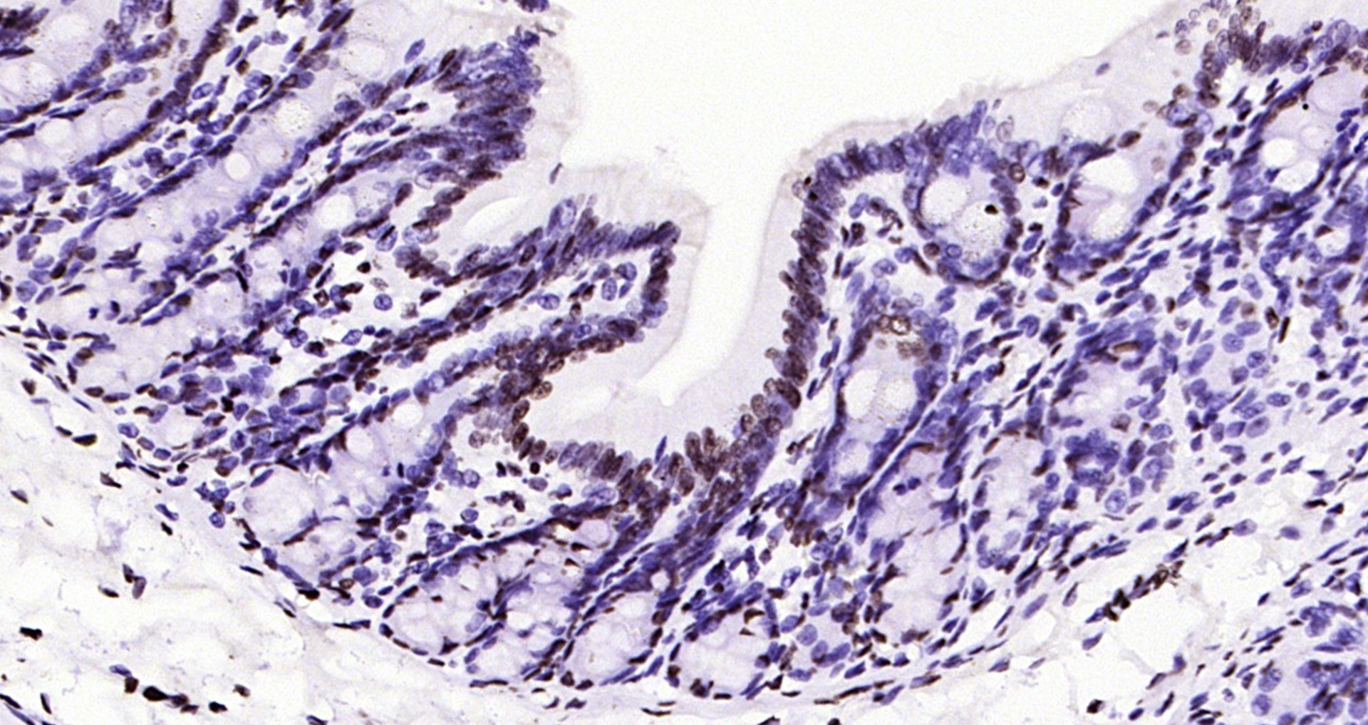 Paraformaldehyde-fixed, paraffin embedded Rat colon; Antigen retrieval by boiling in sodium citrate buffer (pH6.0) for 15min; Block endogenous peroxidase by 3% hydrogen peroxide for 20 minutes; Blocking buffer (normal goat serum) at 37°C for 30min; Antibody incubation with Histone H3 (di methyl K79) Monoclonal Antibody, Unconjugated (bsm-33093M) at 1:200 overnight at 4°C, DAB staining.