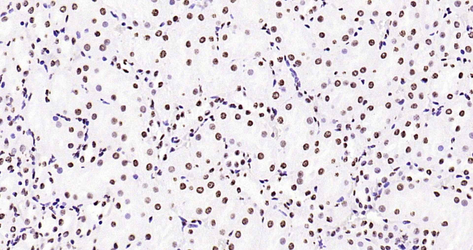 Paraformaldehyde-fixed, paraffin embedded Rat kidney; Antigen retrieval by boiling in sodium citrate buffer (pH6.0) for 15min; Block endogenous peroxidase by 3% hydrogen peroxide for 20 minutes; Blocking buffer (normal goat serum) at 37°C for 30min; Antibody incubation with Histone H3 (di methyl K79) Monoclonal Antibody, Unconjugated (bsm-33093M) at 1:200 overnight at 4°C, DAB staining.