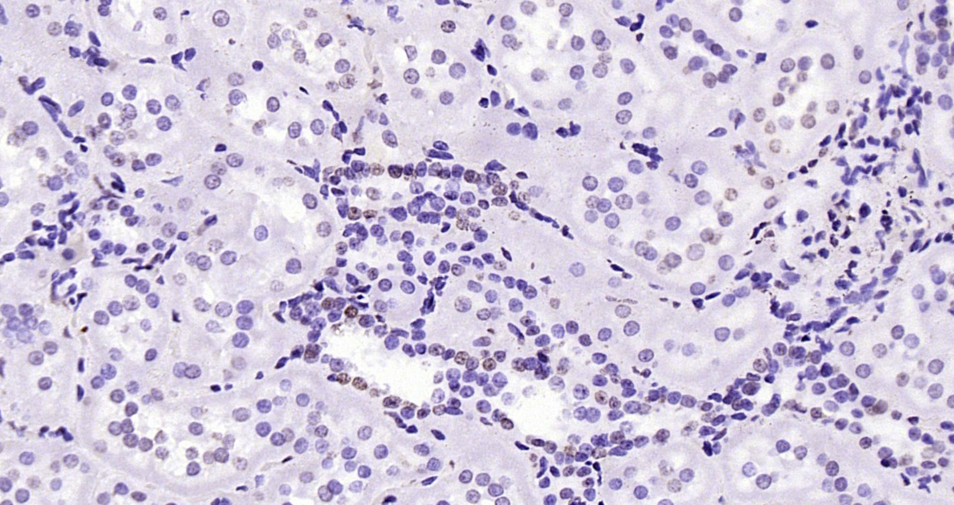 Paraformaldehyde-fixed, paraffin embedded Rat kidney; Antigen retrieval by boiling in sodium citrate buffer (pH6.0) for 15min; Block endogenous peroxidase by 3% hydrogen peroxide for 20 minutes; Blocking buffer (normal goat serum) at 37°C for 30min; Antibody incubation with Histone H3(mono methyl K79) Monoclonal Antibody, Unconjugated (bsm-33104M) at 1:200 overnight at 4°C, DAB staining.