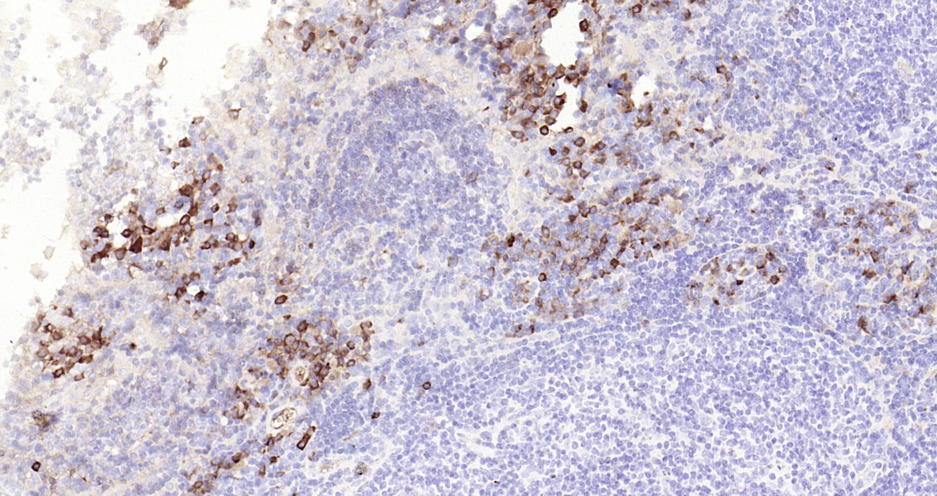 Paraformaldehyde-fixed, paraffin embedded Rat lymph node; Antigen retrieval by boiling in sodium citrate buffer (pH6.0) for 15min; Block endogenous peroxidase by 3% hydrogen peroxide for 20 minutes; Blocking buffer (normal goat serum) at 37°C for 30min; Antibody incubation with Caspase 8 Monoclonal Antibody, Unconjugated (bsm-33190M) at 1:2000 overnight at 4°C, DAB staining.