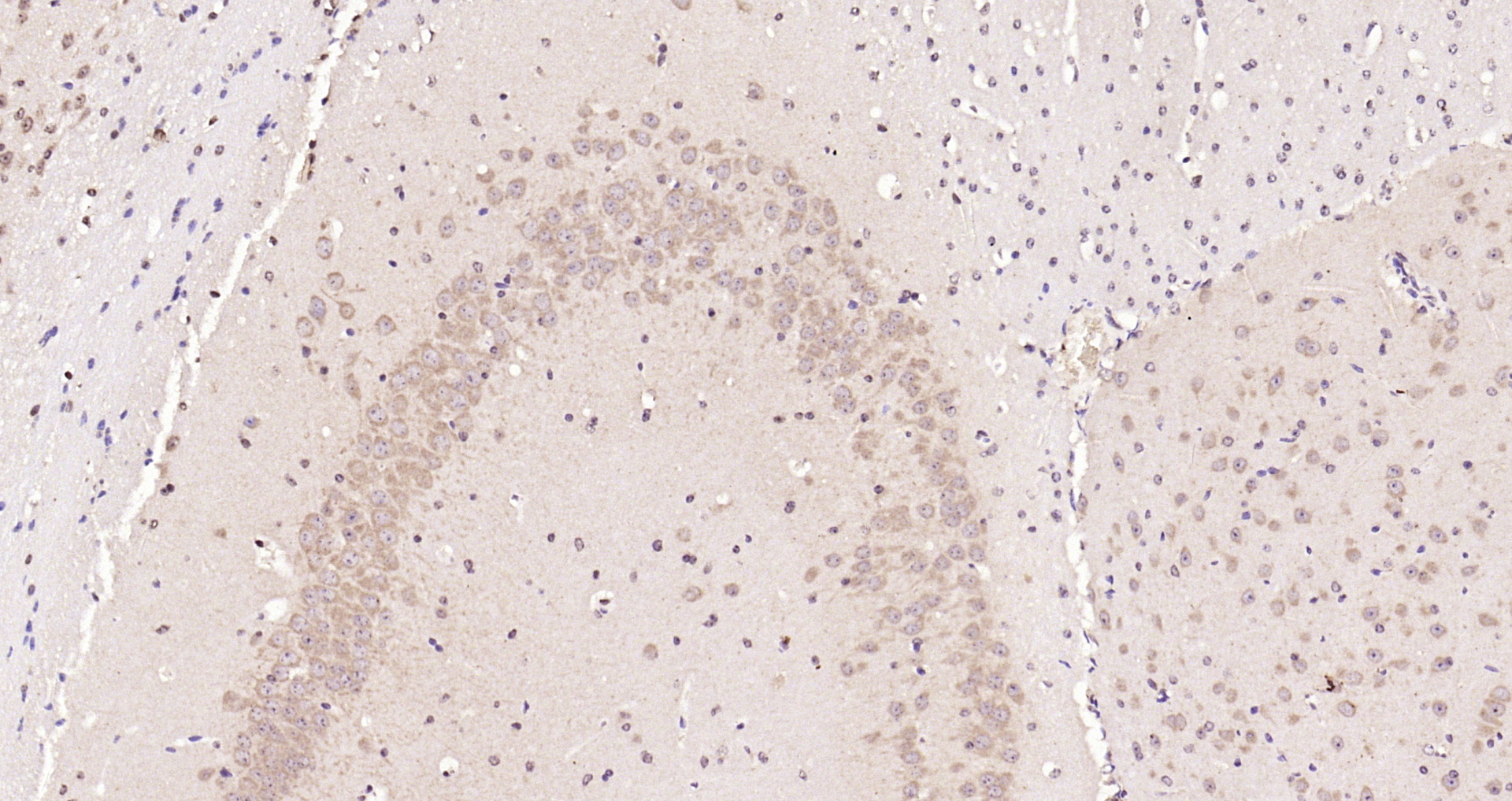 Paraformaldehyde-fixed, paraffin embedded Mouse brain; Antigen retrieval by boiling in sodium citrate buffer (pH6.0) for 15min; Block endogenous peroxidase by 3% hydrogen peroxide for 20 minutes; Blocking buffer (normal goat serum) at 37°C for 30min; Antibody incubation with tubulin Beta Polyclonal Antibody, Unconjugated (bs-4511R) at 1:200 overnight at 4°C, DAB staining.