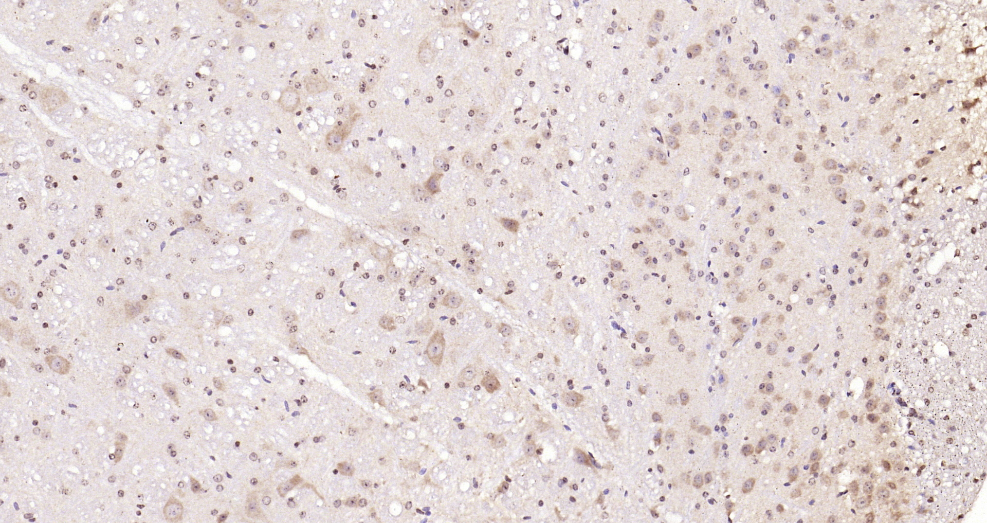 Paraformaldehyde-fixed, paraffin embedded Mouse cerebellum; Antigen retrieval by boiling in sodium citrate buffer (pH6.0) for 15min; Block endogenous peroxidase by 3% hydrogen peroxide for 20 minutes; Blocking buffer (normal goat serum) at 37°C for 30min; Antibody incubation with tubulin Beta Polyclonal Antibody, Unconjugated (bs-4511R) at 1:200 overnight at 4°C, DAB staining.