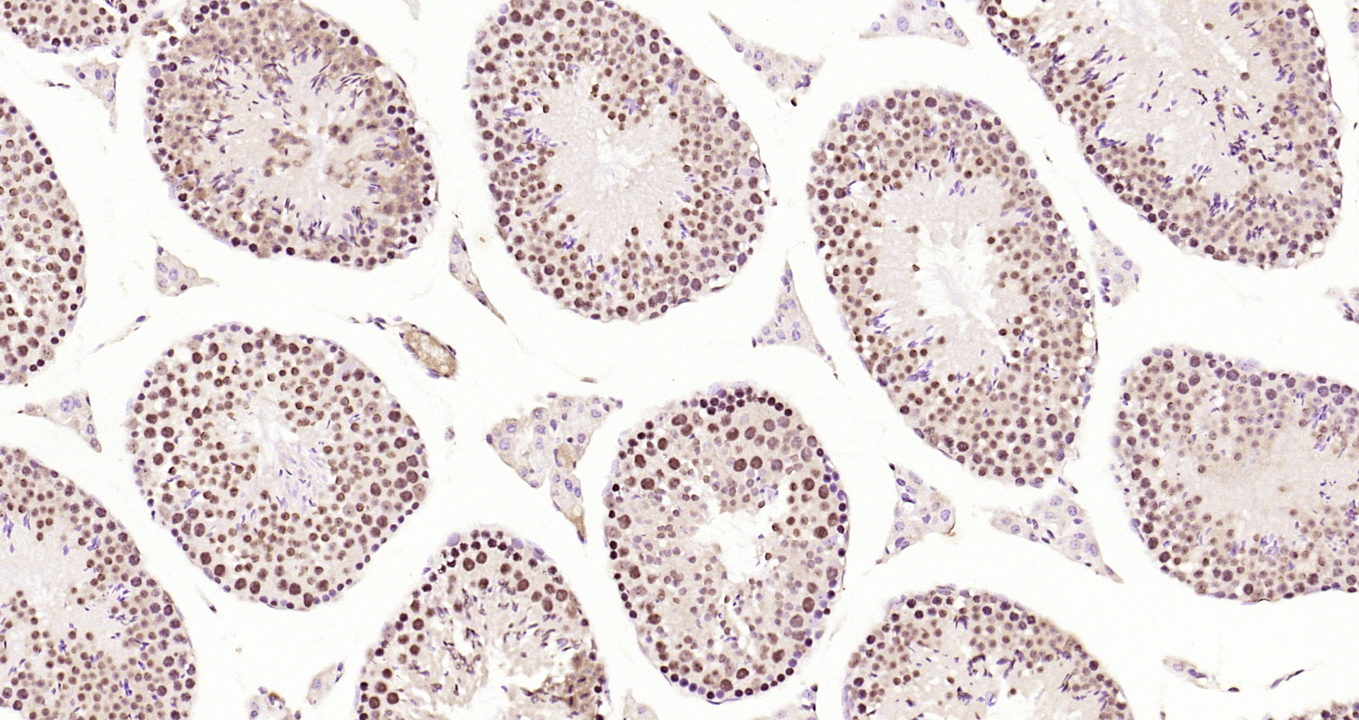 Paraformaldehyde-fixed, paraffin embedded Mouse testis; Antigen retrieval by boiling in sodium citrate buffer (pH6.0) for 15min; Block endogenous peroxidase by 3% hydrogen peroxide for 20 minutes; Blocking buffer (normal goat serum) at 37°C for 30min; Antibody incubation with CDKN1A (Thr145) Polyclonal Antibody, Unconjugated (bs-5237R) at 1:200 overnight at 4°C, DAB staining.