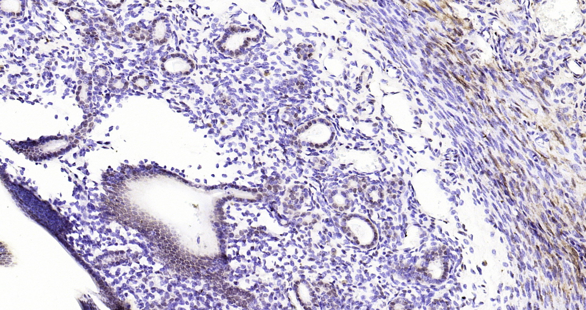 Paraformaldehyde-fixed, paraffin embedded Mouse uterus; Antigen retrieval by boiling in sodium citrate buffer (pH6.0) for 15min; Block endogenous peroxidase by 3% hydrogen peroxide for 20 minutes; Blocking buffer (normal goat serum) at 37°C for 30min; Antibody incubation with CDKN1A (Thr145) Polyclonal Antibody, Unconjugated (bs-5237R) at 1:200 overnight at 4°C, DAB staining.