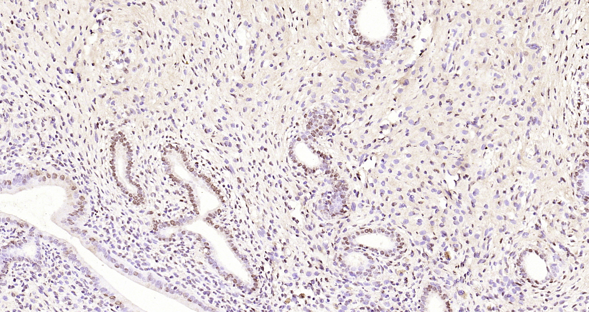 Paraformaldehyde-fixed, paraffin embedded Rat uterus; Antigen retrieval by boiling in sodium citrate buffer (pH6.0) for 15min; Block endogenous peroxidase by 3% hydrogen peroxide for 20 minutes; Blocking buffer (normal goat serum) at 37°C for 30min; Antibody incubation with CDKN1A (Thr145) Polyclonal Antibody, Unconjugated (bs-5237R) at 1:200 overnight at 4°C, DAB staining.