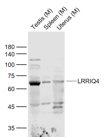 Lane 1: Mouse Testis lysates; Lane 2: Mouse Spleen lysates; Lane 3: Mouse Uterus lysates probed with LRRIQ4 Polyclonal Antibody, Unconjugated (bs-18417R) at 1:1000 dilution and 4˚C overnight incubation. Followed by conjugated secondary antibody incubation at 1:20000 for 60 min at 37˚C.