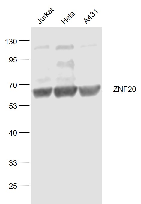 Lane 1: Jurkat cell lysates; Lane 2: Hela cell lysates; Lane 3: A431 cell lysates probed with ZNF20 Polyclonal Antibody, Unconjugated (bs-7179R) at 1:1000 dilution and 4˚C overnight incubation. Followed by conjugated secondary antibody incubation at 1:20000 for 60 min at 37˚C.