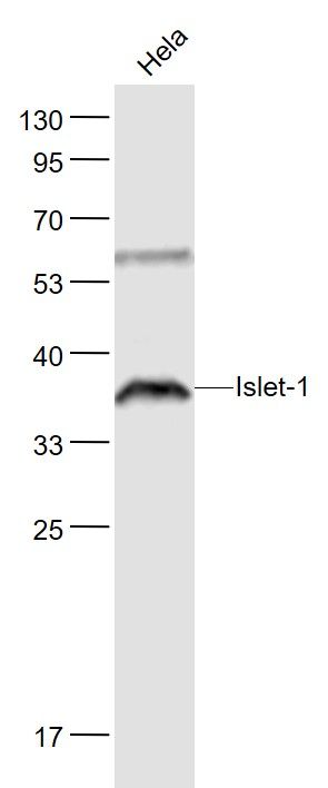 Lane 1: Hela cell lysates probed with Islet-1 Polyclonal Antibody, Unconjugated (bs-7346R) at 1:1000 dilution and 4˚C overnight incubation. Followed by conjugated secondary antibody incubation at 1:20000 for 60 min at 37˚C.