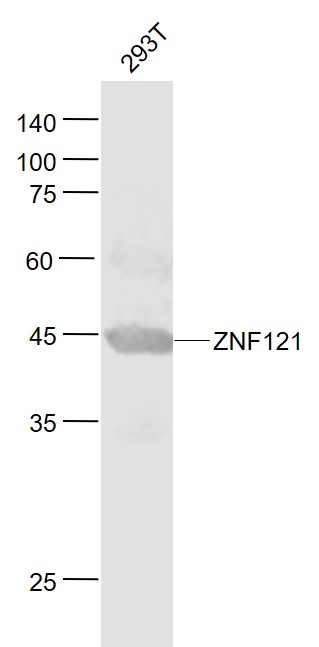 Lane 1: 293T cell lysates probed with ZNF121 Polyclonal Antibody, Unconjugated (bs-7148R) at 1:1000 dilution and 4˚C overnight incubation. Followed by conjugated secondary antibody incubation at 1:20000 for 60 min at 37˚C.