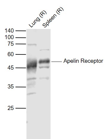 Lane 1: Rat Lung lysates;Lane 2: Rat Spleen lysates probed with Apelin Receptor Polyclonal Antibody, Unconjugated (bs-21310R) at 1:1000 dilution and 4˚C overnight incubation. Followed by conjugated secondary antibody incubation at 1:20000 for 60 min at 37˚C.