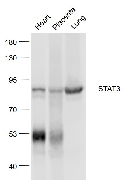 Lane 1: Mouse Heart lysates; Lane 2: Mouse Placenta lysates; Lane 3: Mouse Lung lysates probed with STAT3 Polyclonal Antibody, Unconjugated (bsm-33223M) at 1:1000 dilution and 4˚C overnight incubation. Followed by conjugated secondary antibody incubation at 1:20000 for 60 min at 37˚C.