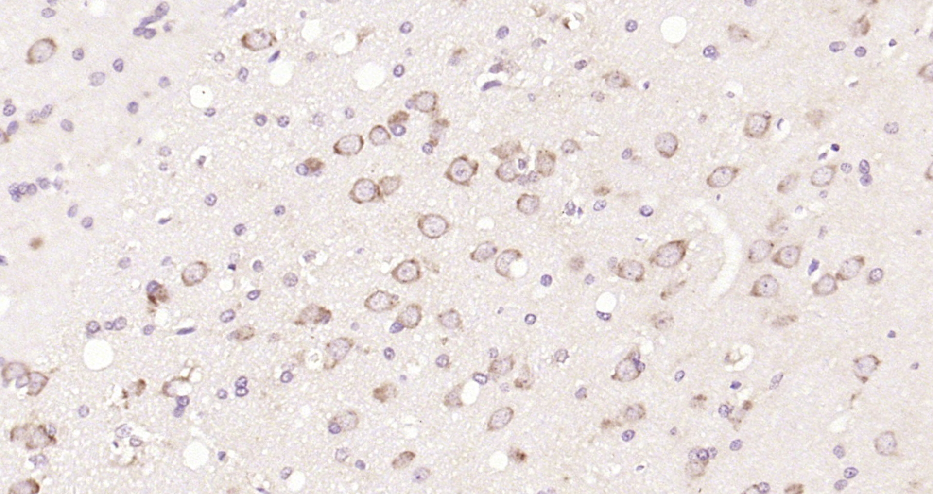 Paraformaldehyde-fixed, paraffin embedded Rat brain; Antigen retrieval by boiling in sodium citrate buffer (pH6.0) for 15min; Block endogenous peroxidase by 3% hydrogen peroxide for 20 minutes; Blocking buffer (normal goat serum) at 37°C for 30min; Antibody incubation with mTOR/FRAP Polyclonal Antibody, Unconjugated (bs-1992R) at 1:200 overnight at 4°C, DAB staining.