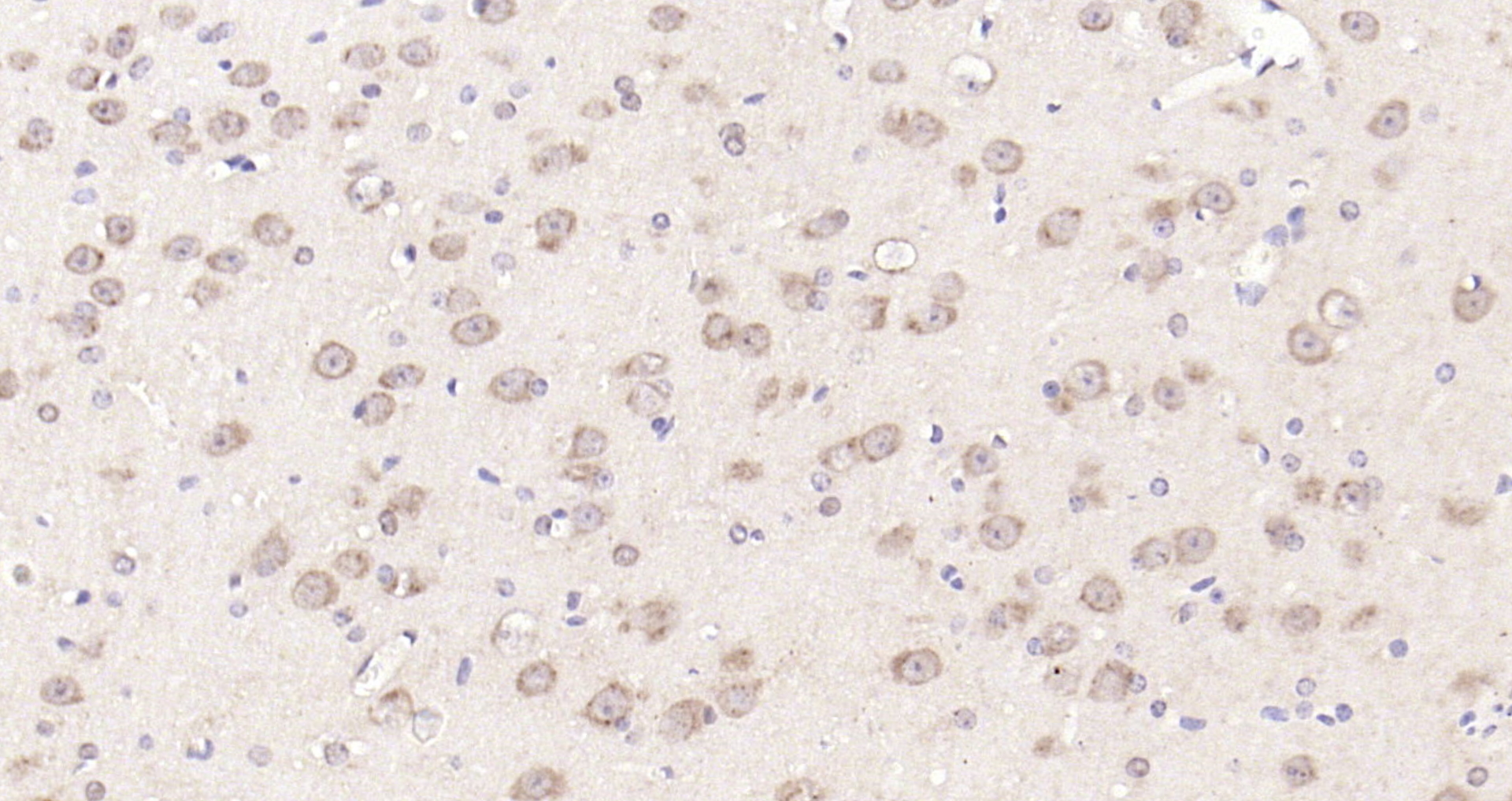 Paraformaldehyde-fixed, paraffin embedded Mouse brain; Antigen retrieval by boiling in sodium citrate buffer (pH6.0) for 15min; Block endogenous peroxidase by 3% hydrogen peroxide for 20 minutes; Blocking buffer (normal goat serum) at 37°C for 30min; Antibody incubation with mTOR/FRAP Polyclonal Antibody, Unconjugated (bs-1992R) at 1:200 overnight at 4°C, DAB staining.