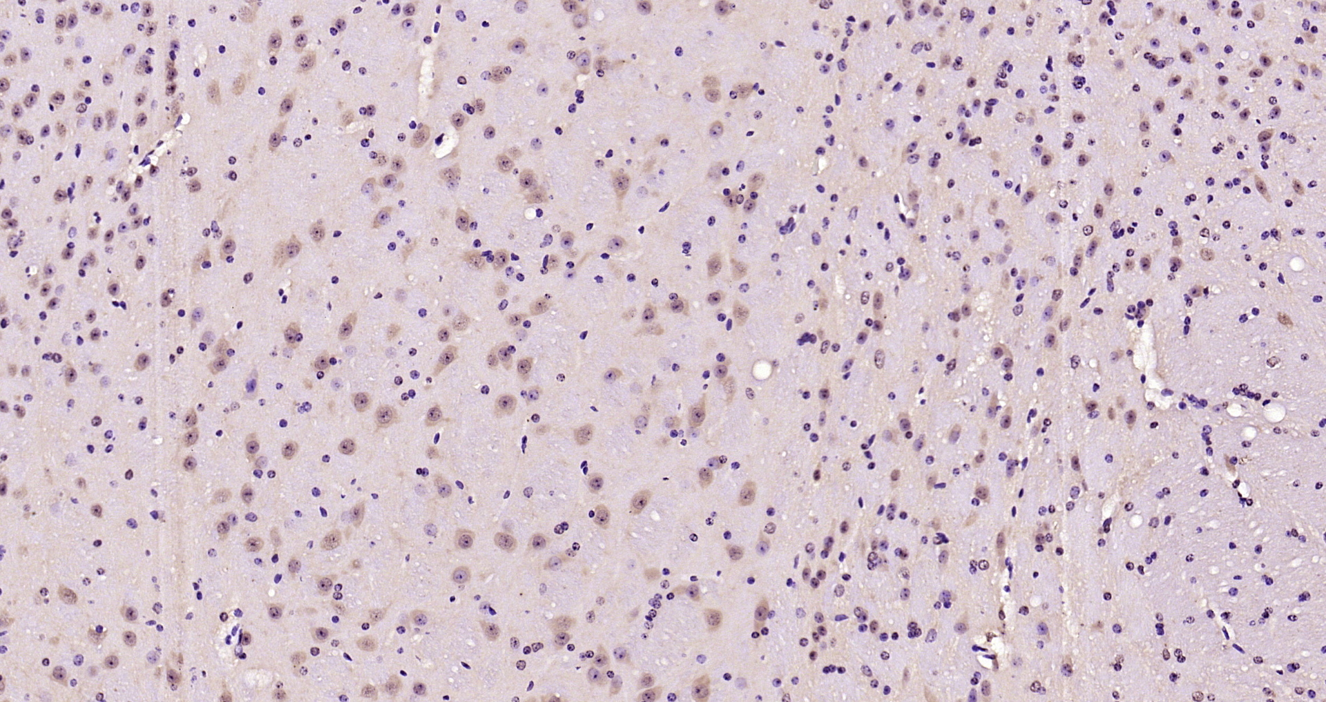 Paraformaldehyde-fixed, paraffin embedded Mouse brain; Antigen retrieval by boiling in sodium citrate buffer (pH6.0) for 15min; Block endogenous peroxidase by 3% hydrogen peroxide for 20 minutes; Blocking buffer (normal goat serum) at 37°C for 30min; Antibody incubation with AMPK alpha-1/2 (Thr183/Thr172) Polyclonal Antibody, Unconjugated (bs-4002R) at 1:200 overnight at 4°C, DAB staining.