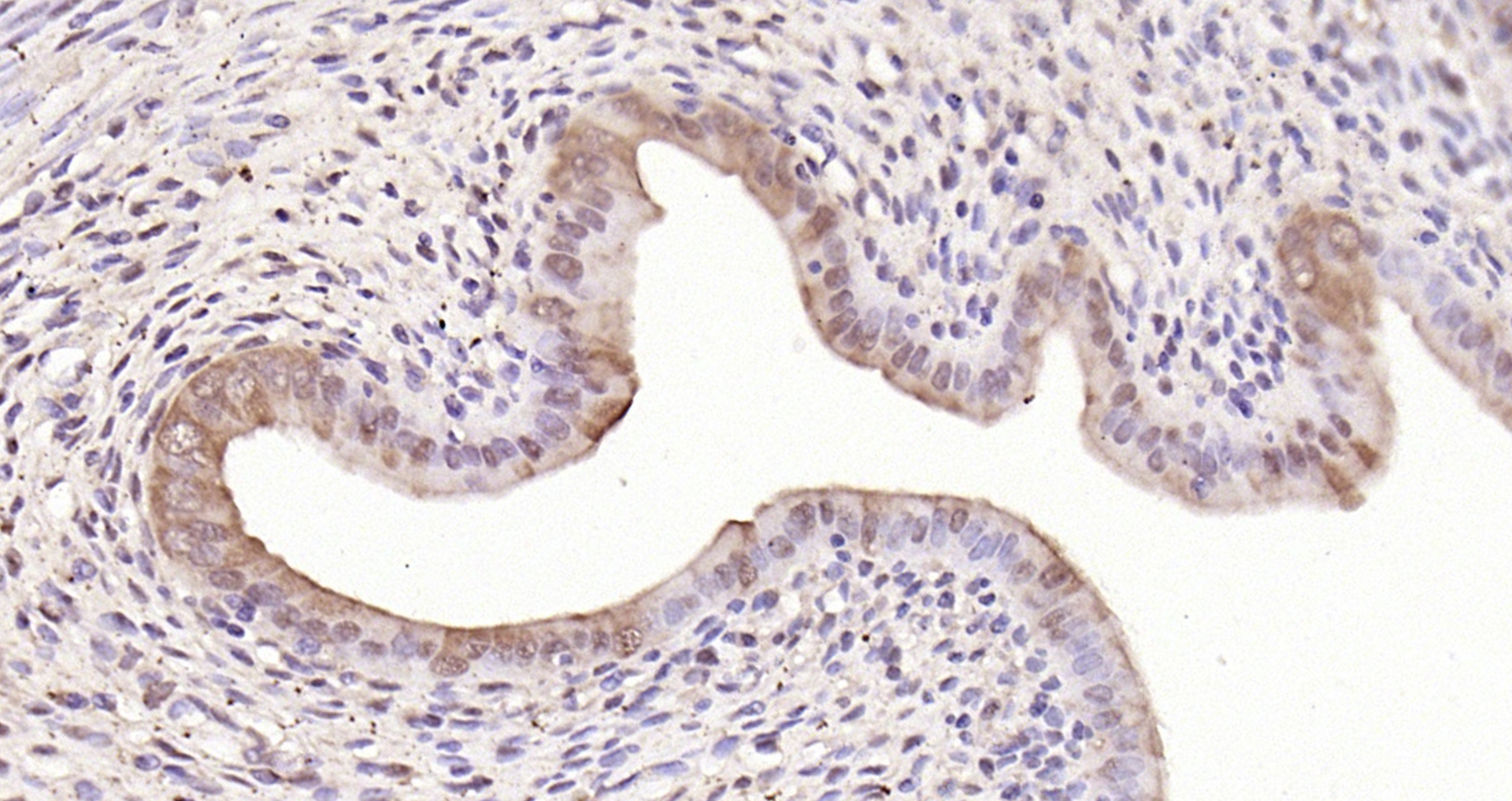 Paraformaldehyde-fixed, paraffin embedded Rat uterus; Antigen retrieval by boiling in sodium citrate buffer (pH6.0) for 15min; Block endogenous peroxidase by 3% hydrogen peroxide for 20 minutes; Blocking buffer (normal goat serum) at 37°C for 30min; Antibody incubation with c-fos Polyclonal Antibody, Unconjugated (bs-0469R) at 1:200 overnight at 4°C, DAB staining.