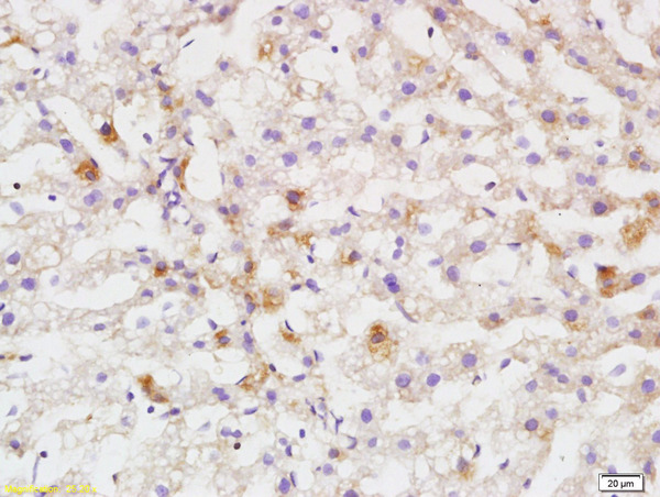 Formalin-fixed and paraffin embedded rat liver labeled with Anti DEPTOR/DEPDC6 Polyclonal Antibody, Unconjugated (bs-8255R) at 1:200 followed by conjugation to the secondary antibody and DAB staining Formalin-fixed and paraffin embedded rat liver labeled with Anti DEPTOR/DEPDC6 Polyclonal Antibody, Unconjugated (bs-8255R) at 1:200 followed by conjugation to the secondary antibody and DAB staining