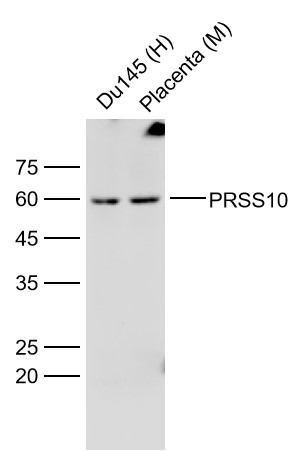 Lane 1: Du145 cell lysates; Lane 2: Mouse Placenta lysates probed with PRSS10/TMPRSS2 Polyclonal Antibody, Unconjugated (bs-6285R) at 1:300 dilution and 4˚C overnight incubation. Followed by conjugated secondary antibody incubation at 1:20000 for 60 min at 37˚C.