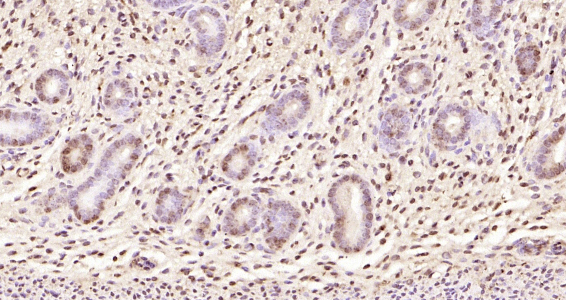 Paraformaldehyde-fixed, paraffin embedded Rat uterus; Antigen retrieval by boiling in sodium citrate buffer (pH6.0) for 15min; Block endogenous peroxidase by 3% hydrogen peroxide for 20 minutes; Blocking buffer (normal goat serum) at 37°C for 30min; Antibody incubation with CDKN1A Polyclonal Antibody, Unconjugated (bs-0741R) at 1:200 overnight at 4°C, DAB staining.