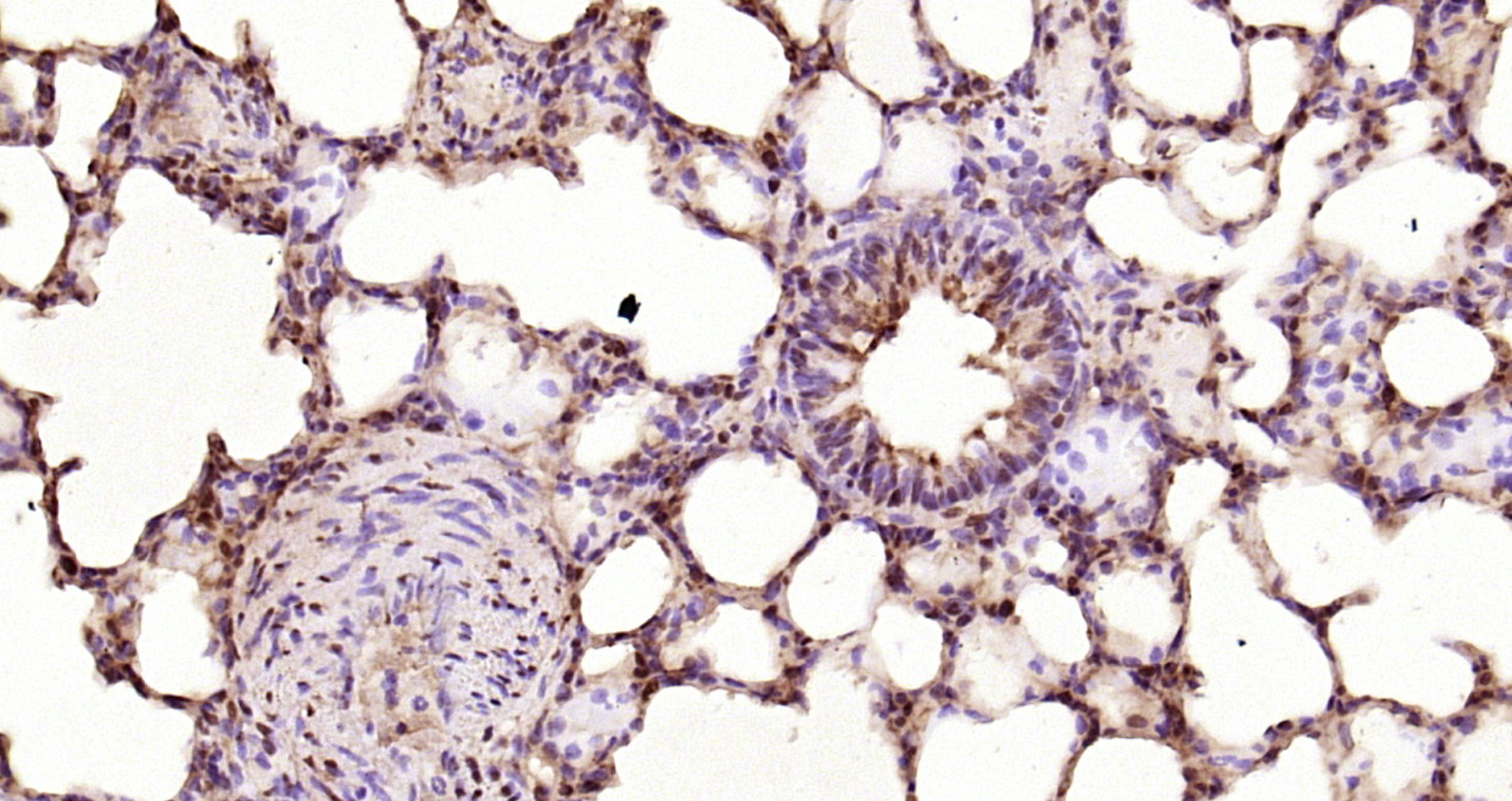 Paraformaldehyde-fixed, paraffin embedded Rat lung; Antigen retrieval by boiling in sodium citrate buffer (pH6.0) for 15min; Block endogenous peroxidase by 3% hydrogen peroxide for 20 minutes; Blocking buffer (normal goat serum) at 37°C for 30min; Antibody incubation with CDKN1A (Ser130) Polyclonal Antibody, Unconjugated (bs-5274R) at 1:200 overnight at 4°C, DAB staining.