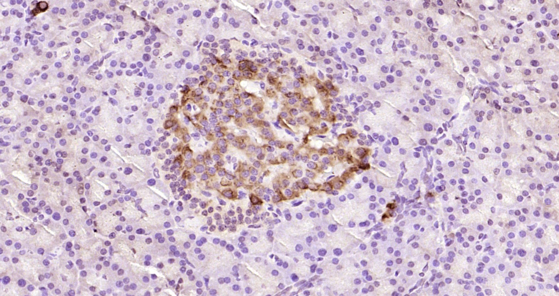 Paraformaldehyde-fixed, paraffin embedded Rat pancreas; Antigen retrieval by boiling in sodium citrate buffer (pH6.0) for 15min; Block endogenous peroxidase by 3% hydrogen peroxide for 20 minutes; Blocking buffer (normal goat serum) at 37°C for 30min; Antibody incubation with Insulin Polyclonal Antibody, Unconjugated (bs-0056R) at 1:200 overnight at 4°C, DAB staining.