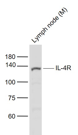 Lane 1: Mouse Lymph node lysates probed with IL-4R Polyclonal Antibody, Unconjugated (bs-23579R) at 1:1000 dilution and 4˚C overnight incubation. Followed by conjugated secondary antibody incubation at 1:20000 for 60 min at 37˚C.