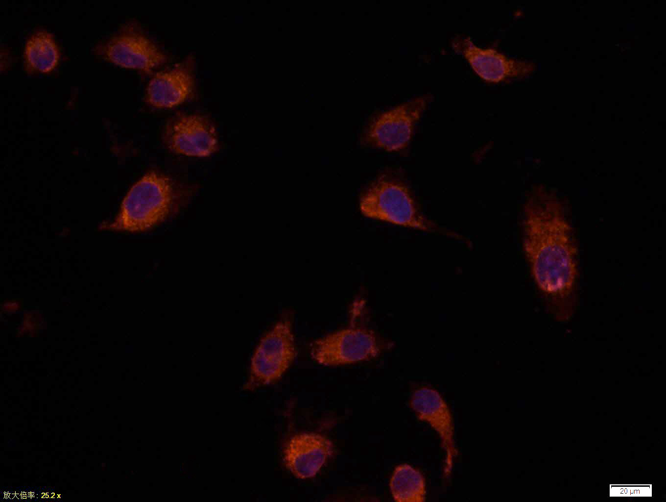 Tissue/cell: Hela cell; 4% Paraformaldehyde-fixed; Triton X-100 at room temperature for 20 min; Blocking buffer (normal goat serum, C-0005) at 37°C for 20 min; Antibody incubation with (Bax) polyclonal Antibody, Unconjugated (bs-0127M) 1:100, 90 minutes at 37°C; followed by a CY3 conjugated Goat Anti-Mouse IgG antibody at 37°C for 90 minutes, DAPI (blue, C02-04002) was used to stain the cell nuclei.