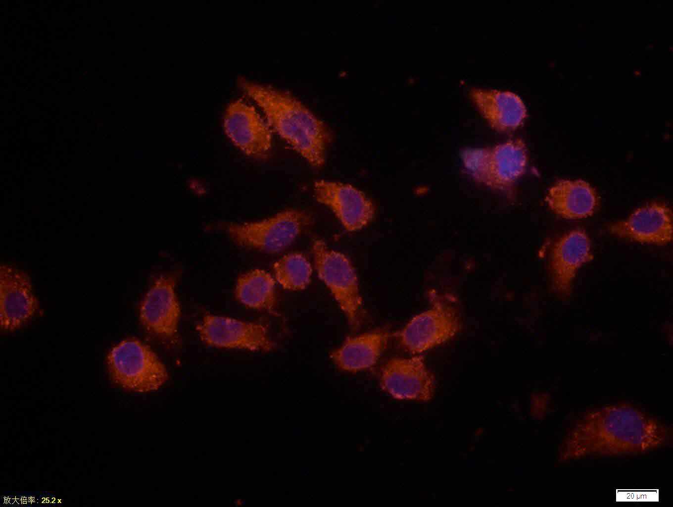 Tissue/cell: Hela cell; 4% Paraformaldehyde-fixed; Triton X-100 at room temperature for 20 min; Blocking buffer (normal goat serum, C-0005) at 37°C for 20 min; Antibody incubation with (Bax) monoclonal Antibody, Unconjugated (bsm-33283M) 1:100, 90 minutes at 37°C; followed by a CY3 conjugated Goat Anti-Mouse IgG antibody at 37°C for 90 minutes, DAPI (blue, C02-04002) was used to stain the cell nuclei.