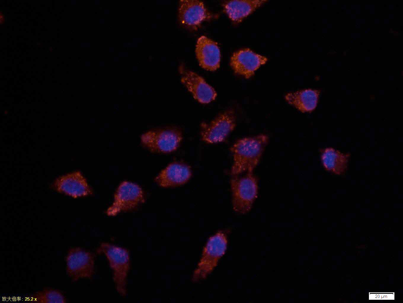 Tissue/cell: Hela cell; 4% Paraformaldehyde-fixed; Triton X-100 at room temperature for 20 min; Blocking buffer (normal goat serum, C-0005) at 37°C for 20 min; Antibody incubation with (Bax) monoclonal Antibody, Unconjugated (bs-33279M) 1:100, 90 minutes at 37°C; followed by a CY3 conjugated Goat Anti-Mouse IgG antibody at 37°C for 90 minutes, DAPI (blue, C02-04002) was used to stain the cell nuclei.