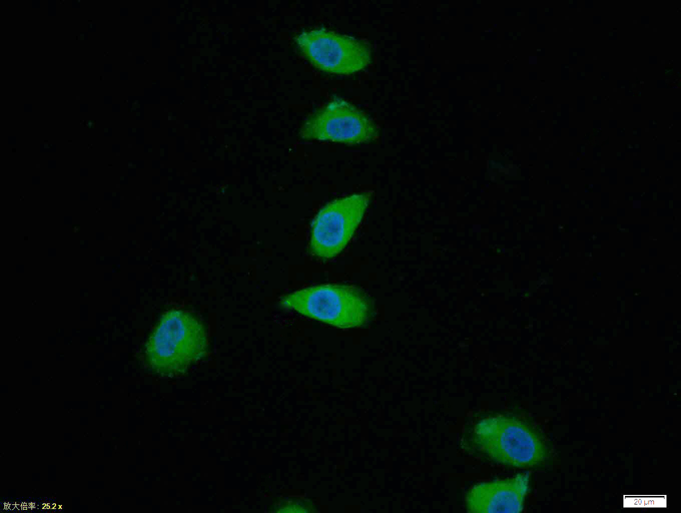 Tissue/cell: Hela cell; 4% Paraformaldehyde-fixed; Triton X-100 at room temperature for 20 min; Blocking buffer (normal goat serum, C-0005) at 37°C for 20 min; Antibody incubation with (phospho-p38 MAPK (Thr180 + Tyr182)) polyclonal Antibody, Unconjugated (bs-2210R) 1:100, 90 minutes at 37°C; followed by a FITC conjugated Goat Anti-Rabbit IgG antibody at 37°C for 90 minutes, DAPI (blue, C02-04002) was used to stain the cell nuclei.