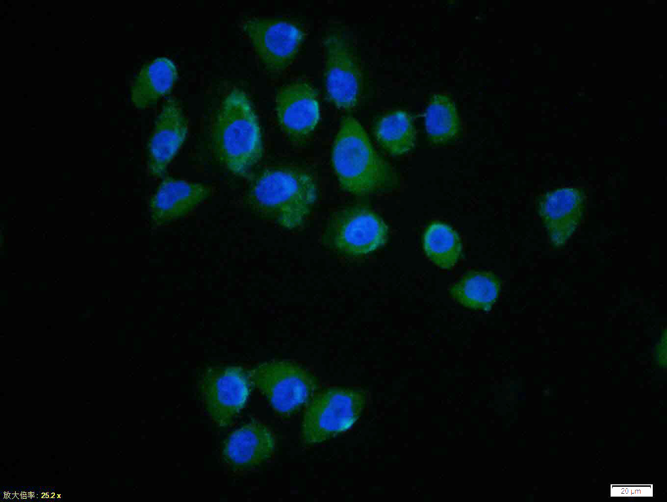 Tissue/cell: Hela cell; 4% Paraformaldehyde-fixed; Triton X-100 at room temperature for 20 min; Blocking buffer (normal goat serum, C-0005) at 37°C for 20 min; Antibody incubation with (ERK1 + ERK2) polyclonal Antibody, Unconjugated (bs-0022R) 1:100, 90 minutes at 37°C; followed by a FITC conjugated Goat Anti-Rabbit IgG antibody at 37°C for 90 minutes, DAPI (blue, C02-04002) was used to stain the cell nuclei.