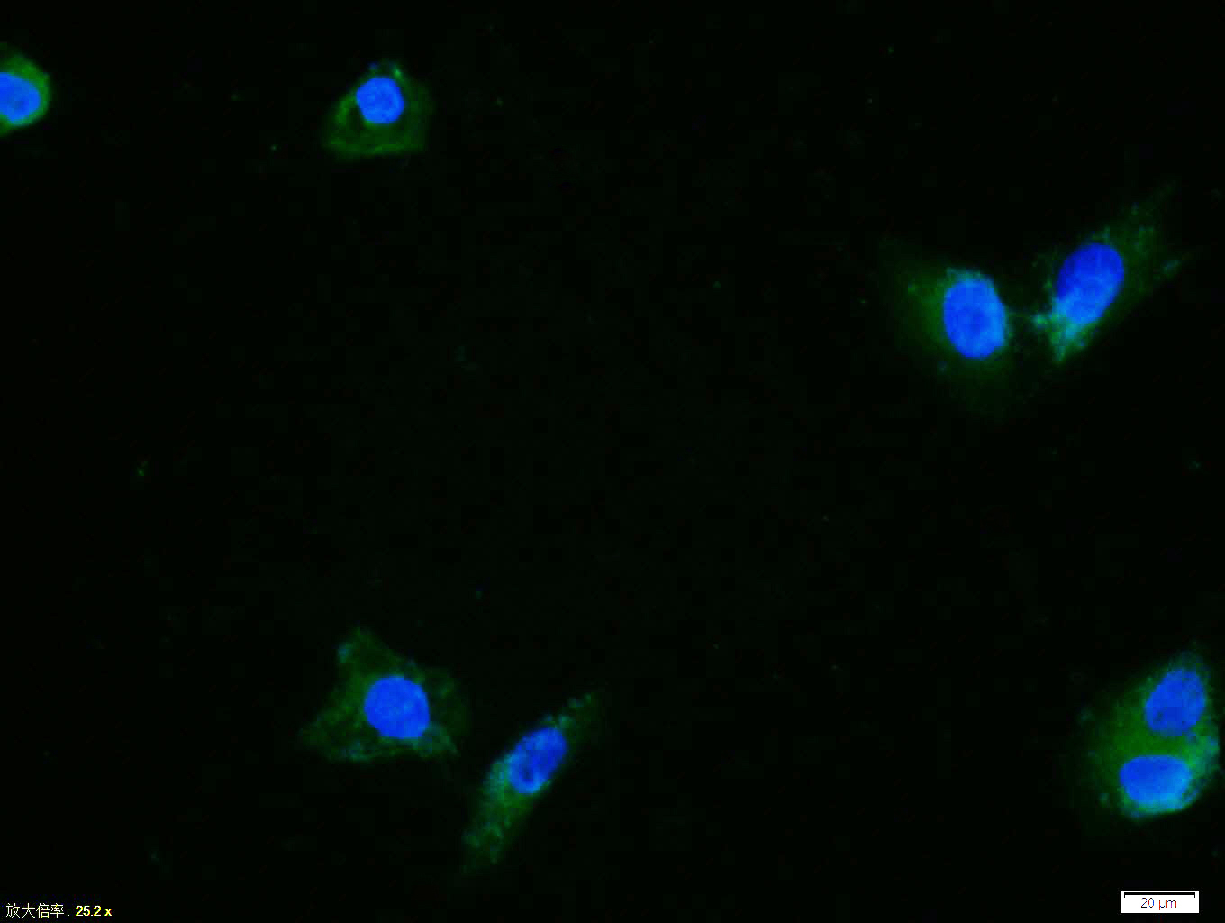 Tissue/cell: Hela cell; 4% Paraformaldehyde-fixed; Triton X-100 at room temperature for 20 min; Blocking buffer (normal goat serum, C-0005) at 37°C for 20 min; Antibody incubation with (ERK1) polyclonal Antibody, Unconjugated (bs-1020R) 1:100, 90 minutes at 37°C; followed by a FITC conjugated Goat Anti-Rabbit IgG antibody at 37°C for 90 minutes, DAPI (blue, C02-04002) was used to stain the cell nuclei.