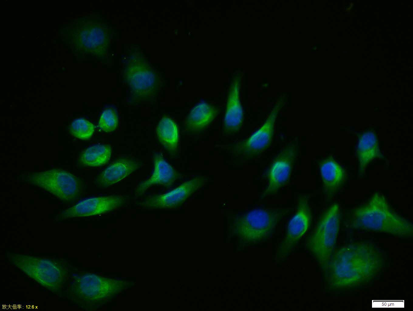Tissue\/cell: Hela cell; 4% Paraformaldehyde-fixed; Triton X-100 at room temperature for 20 min; Blocking buffer (normal goat serum, C-0005) at 37\u00b0C for 20 min; Antibody incubation with (Beclin 1) polyclonal Antibody, Unconjugated (bs-1353R ) 1:100, 90 minutes at 37\u00b0C; followed by a FITC conjugated Goat Anti-Rabbit IgG antibody at 37\u00b0C for 90 minutes, DAPI (blue, C02-04002) was used to stain the cell nuclei.