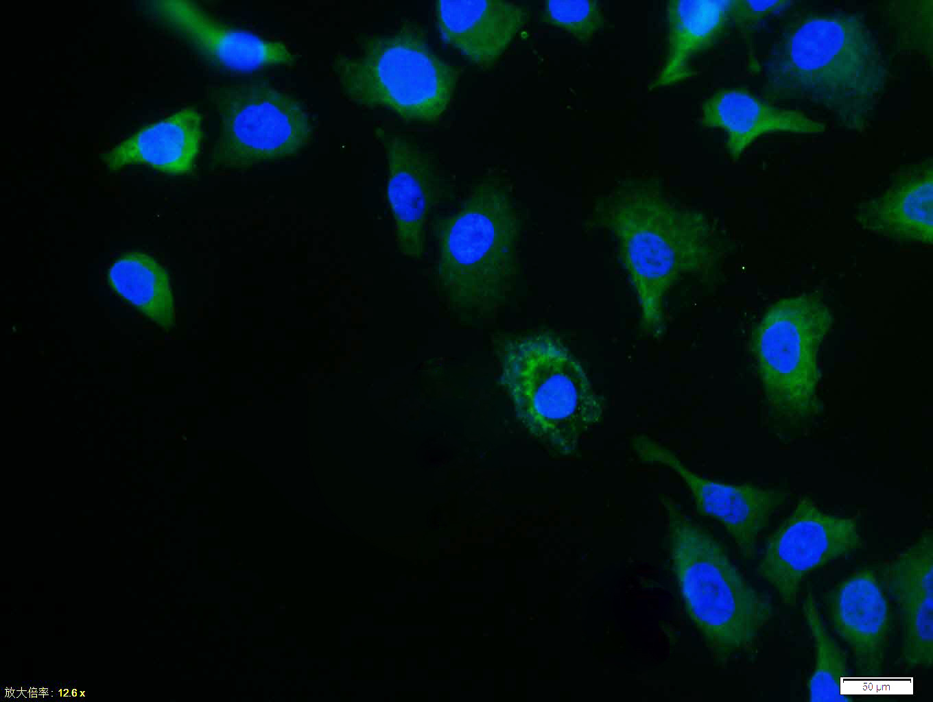 Tissue/cell: Hela cell; 4% Paraformaldehyde-fixed; Triton X-100 at room temperature for 20 min; Blocking buffer (normal goat serum, C-0005) at 37°C for 20 min; Antibody incubation with (Caspase 8) polyclonal Antibody, Unconjugated (bs-0052R) 1:100, 90 minutes at 37°C; followed by a FITC conjugated Goat Anti-Rabbit IgG antibody at 37°C for 90 minutes, DAPI (blue, C02-04002) was used to stain the cell nuclei.