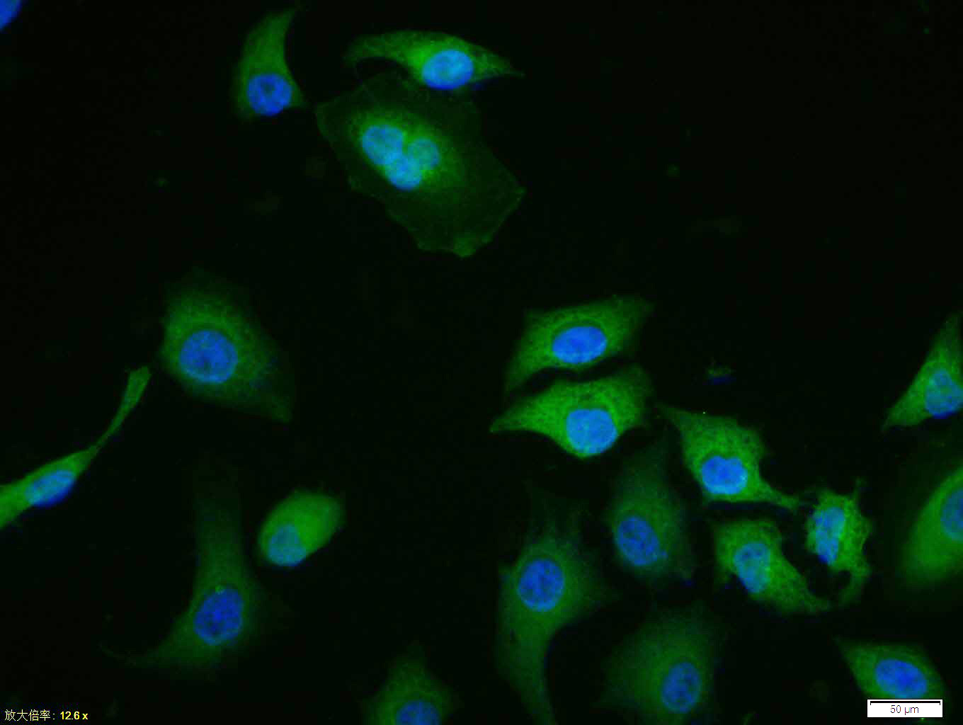 Tissue/cell: Hela cell; 4% Paraformaldehyde-fixed; Triton X-100 at room temperature for 20 min; Blocking buffer (normal goat serum, C-0005) at 37°C for 20 min; Antibody incubation with (phospho-ERK1/2 (Thr202 + Tyr204)) polyclonal Antibody, Unconjugated (bs-3016R) 1:100, 90 minutes at 37°C; followed by a FITC conjugated Goat Anti-Rabbit IgG antibody at 37°C for 90 minutes, DAPI (blue, C02-04002) was used to stain the cell nuclei.