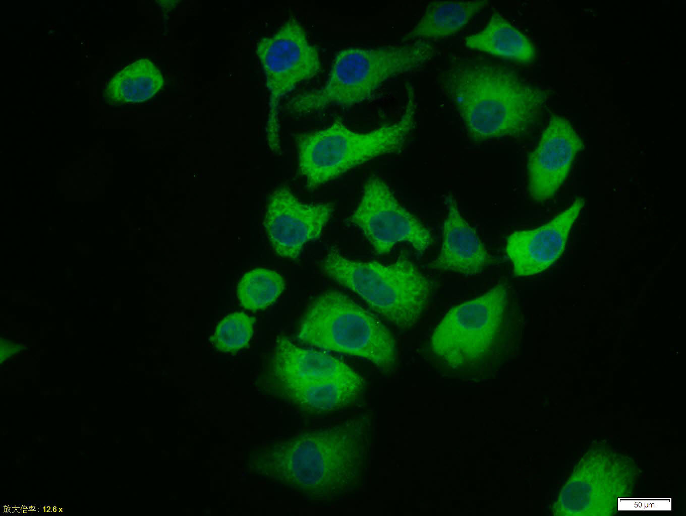 Tissue/cell: Hela cell; 4% Paraformaldehyde-fixed; Triton X-100 at room temperature for 20 min; Blocking buffer (normal goat serum, C-0005) at 37°C for 20 min; Antibody incubation with (phospho-ERK1 + 2 (Thr183/Tyr185)) polyclonal Antibody, Unconjugated (bs-1522R) 1:100, 90 minutes at 37°C; followed by a FITC conjugated Goat Anti-Rabbit IgG antibody at 37°C for 90 minutes, DAPI (blue, C02-04002) was used to stain the cell nuclei.